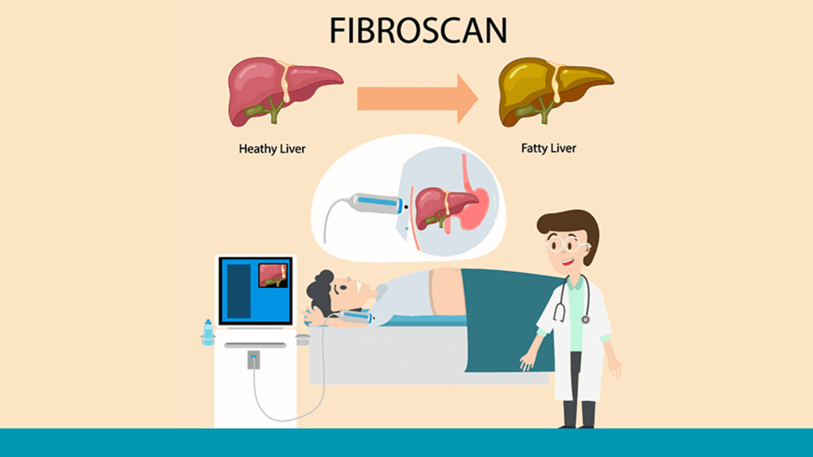 FibroScan Technology